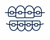 Ilustración de brackets de ortodoncia – tratamiento ofrecido en Consultorio Dental Nuevo Amanecer