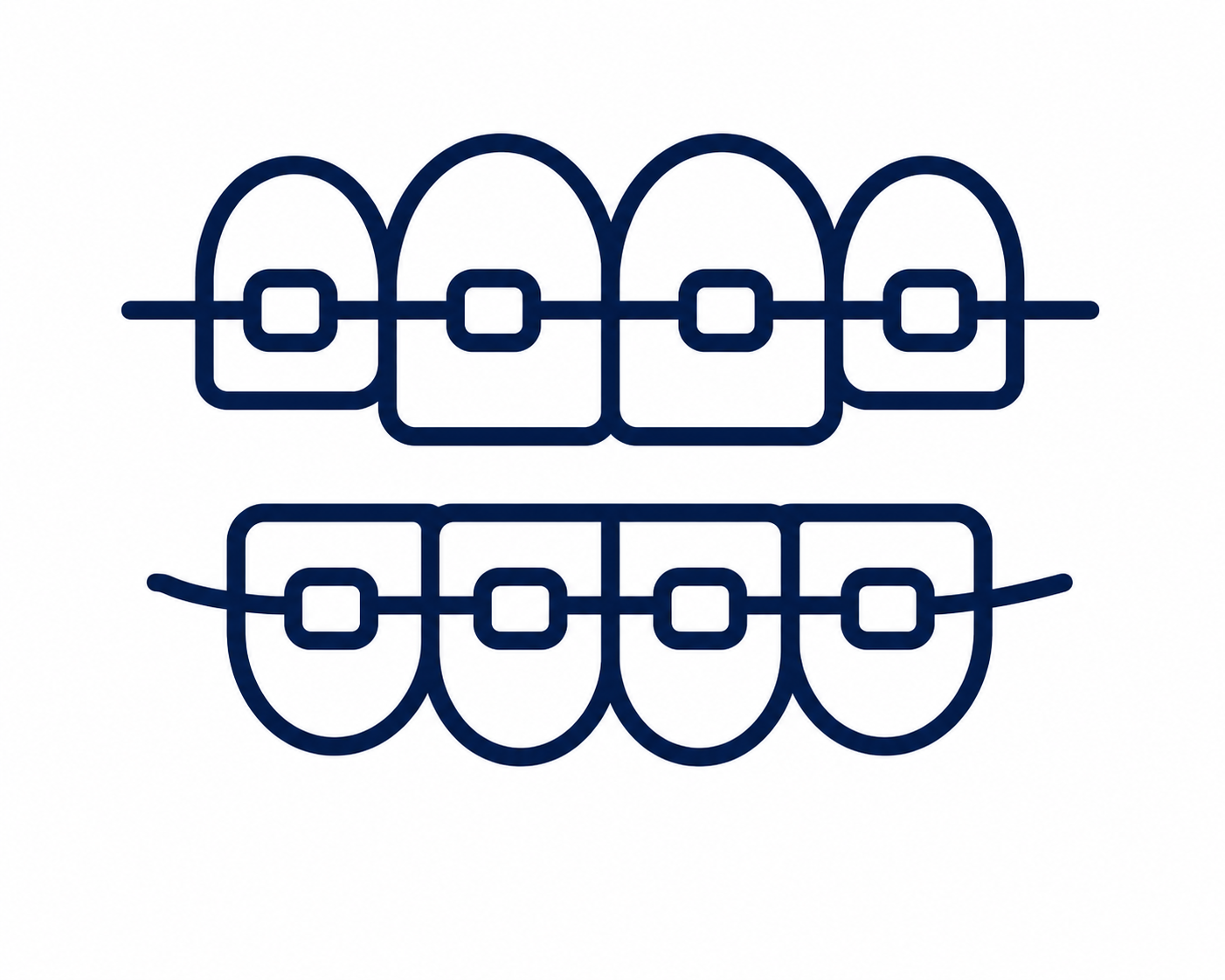Ilustración de brackets de ortodoncia – tratamiento ofrecido en Consultorio Dental Nuevo Amanecer