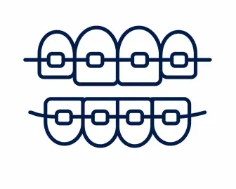 Ilustración de brackets de ortodoncia – tratamiento ofrecido en Consultorio Dental Nuevo Amanecer